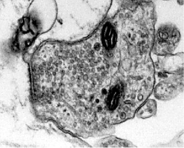 Electron microscopy picture of a synapse from cultured hippocampal neurons.