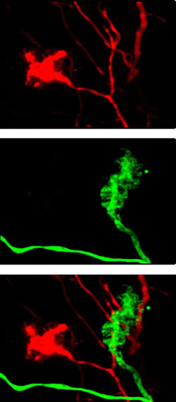 Cerebellar mossy fiber boutons labeled with dextran dye (red) and GFP (green).