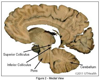 Medial View of the Myelencephalon
