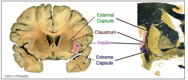 Overview - External Capsule, Claustrum, etc.