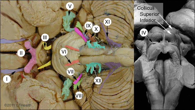Cranial Nerves of Telencephalon and Diencephalon