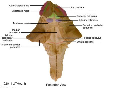 Cranial Nerves of the Pons - Posterior View