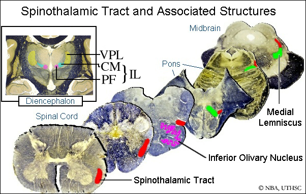 Overview - Spinothalamic Pathways