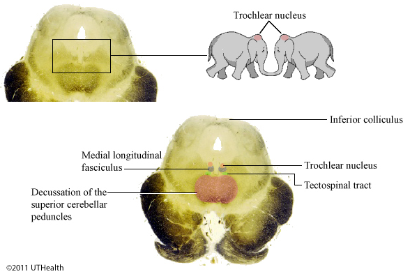 neuroanatomy-online-lab-10-cranial-nerve-nuclei-and-brain-stem