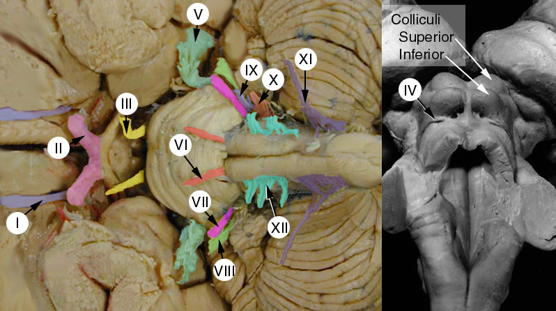 Lab 10 - Cranial Nerve Nuclei and Brain Stem Circulation - Points of