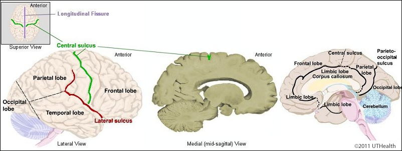 brain fissures