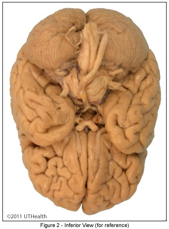 Cerebral Lobes - Frontal Lobe - Inferior View