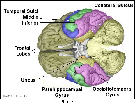 middle temporal sulcus