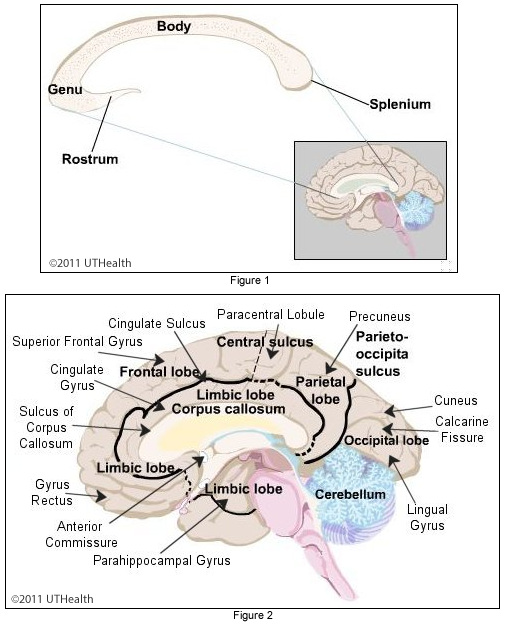 Cerebral Lobes - Medial Structures