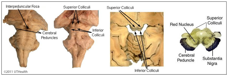 inferior colliculus