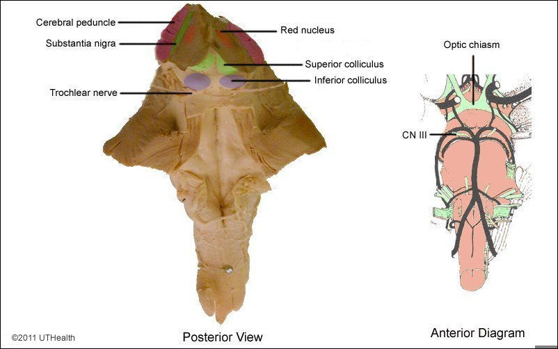 Cranial Nerves of the Midbrain