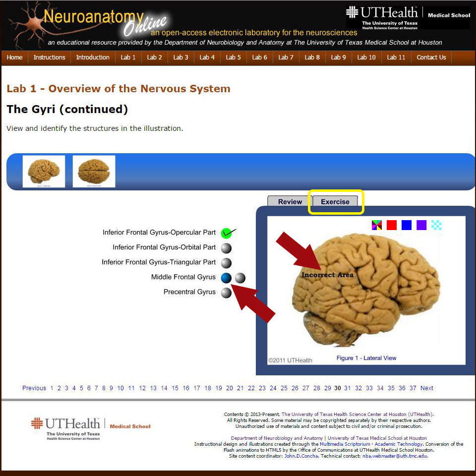 Neuroanatomy Video Lab: Brain Dissections – EHSL Digital