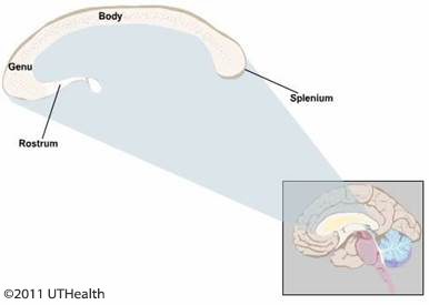 Figure 12. (Click to enlarge) Midsagittal drawing of the brain stem.