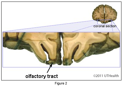 Olfactory Trigone