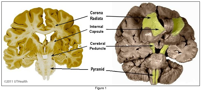 corticobulbar tract in spinal cord