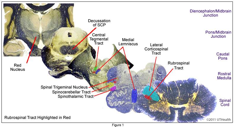 The Rubrospinal Pathway-Overview