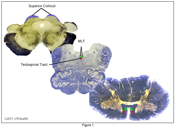 The Tectospinal Pathway