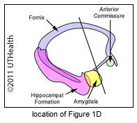 Coronal to Tuberal Region of Hypothalamus