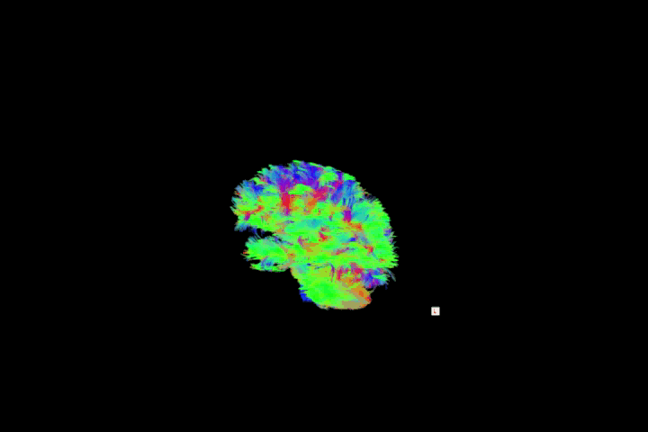 Ellmore Brain. width=